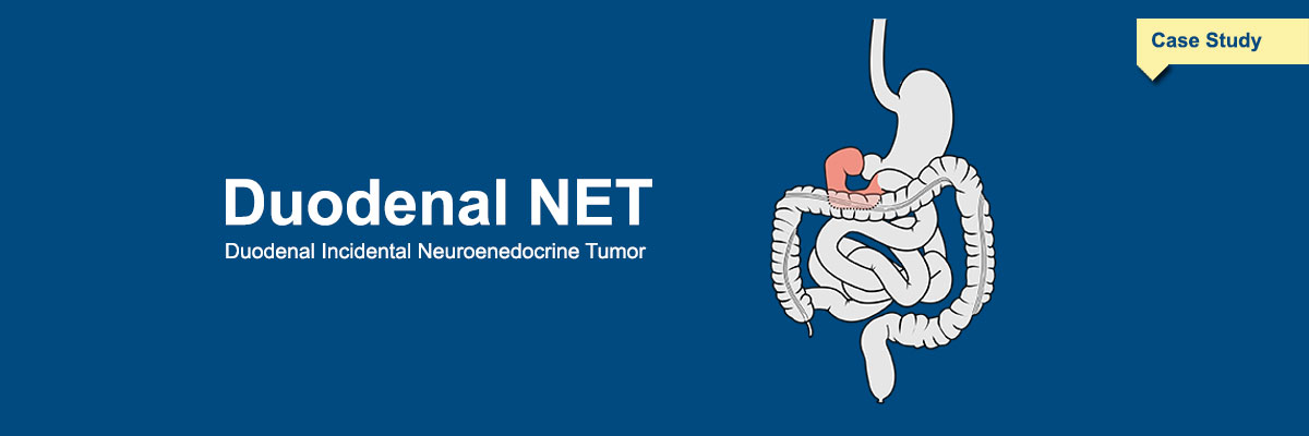 Duodenal NET