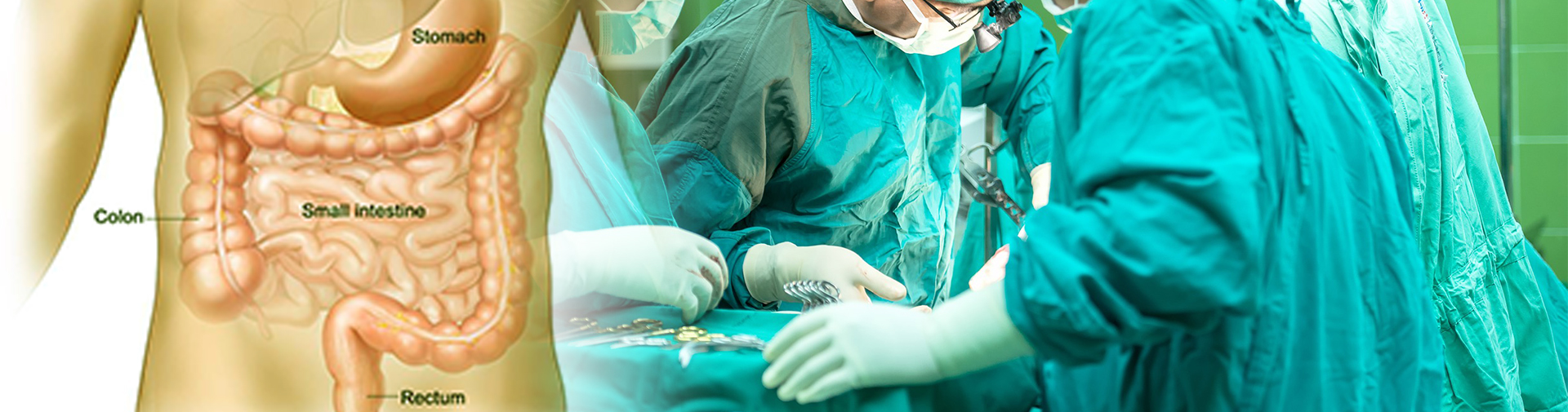 Gastrointestinal Surgery in mumbai