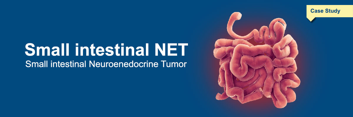 Small intestinal NET