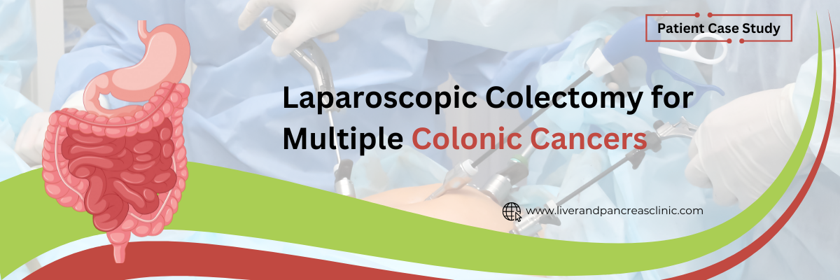 Laparoscopic Colectomy