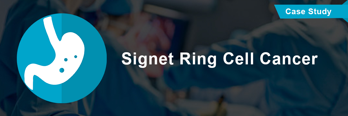 Signet ring cell cancer